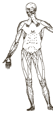Body map, front: MS6 · Head & face